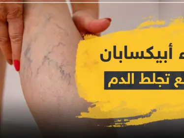 دواء أبيكسابان لمنع التجلط الدموي - وكالة ستيب نيوز