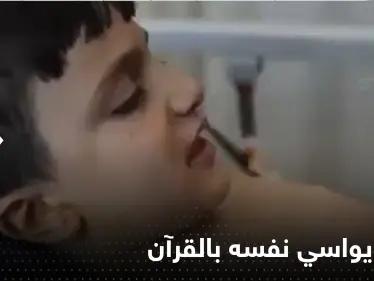شاهد|| طفل سوري يواسي نفسه بقراءة القرآن الكريم أثناء تضميد جراحه بعد قصف مدينة الباب - وكالة ستيب نيوز