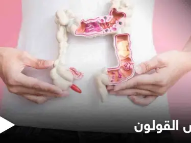 3 أمراض تصيب القولون تعرف على أعراضها وكيفية التفريق بينها - وكالة ستيب نيوز