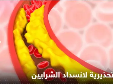 علامة تحذيرية بسيطة تكشف انسداد الشرايين بسبب الكوليسترول.. إياك تجاهلها - وكالة ستيب نيوز