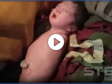 بالفيديو|| بـ حالة طبية نادرة جداً.. طفلة تولد بدون أطراف - وكالة ستيب نيوز