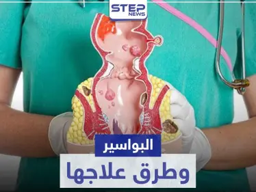 أفضل علاج للبواسير في المنزل و الصيدليات - وكالة ستيب نيوز