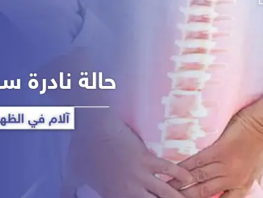 سببت آلام في الظهر.. حالة نادرة لرجل تدهش الأطباء - وكالة ستيب نيوز