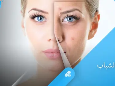 أسباب ظهور حب الشباب وطرق العلاج الفعالة إليك أهم المعلومات - وكالة ستيب نيوز