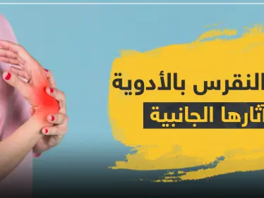 علاج النقرس بالأدوية وآثارها الجانبية - وكالة ستيب نيوز