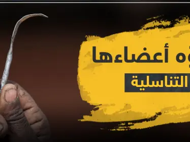 شوه أعضاءها التناسلية بعملية ختان.. طبيب مصري أمام المحكمة - وكالة ستيب نيوز