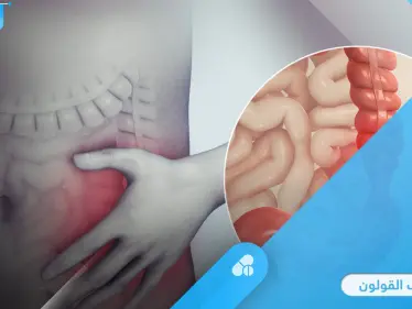 تنظيف القولون بطرق سهلة وبسيطة في المنزل لتفادي أمراضه الخطيرة إليك أهمها - وكالة ستيب نيوز