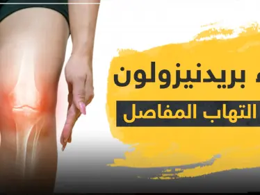 دواء prednisolone بريدنيزولون لعلاج التهاب المفاصل - وكالة ستيب نيوز