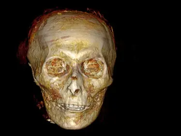 شاهد|| الكشف عن أسرار مومياء الملك أمنحتب الأول بالأشعة المقطعية لأول مرة - وكالة ستيب نيوز