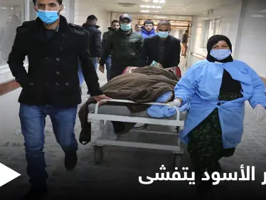 الفطر الأسود يُنهي حياة ضابطٌ رفيع وينتشر في محافظات عراقية - وكالة ستيب نيوز