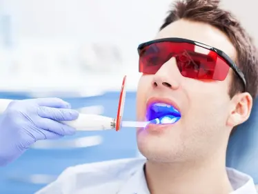 تبييض الأسنان بالليزر.. طريقة العملة وأضرارها وفوائدها مع تكلفة إجرائها - وكالة ستيب نيوز