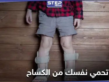 لين العظام.. كيف تحمي نفسك وأطفالك من خطر الإصابة بالكساح؟ - وكالة ستيب نيوز