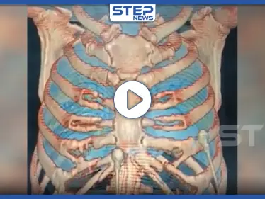 شاهد مراحل تغلغل فيروس كورونا وتأثيره على جسم الإنسان خطوة بخطوة (فيديو) - وكالة ستيب نيوز