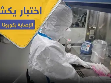 اختبار يكشف الإصابة بـ كورونا خلال 15 دقيقة بدل 15 يوماً .. تعلنه دولة غربية - وكالة ستيب نيوز