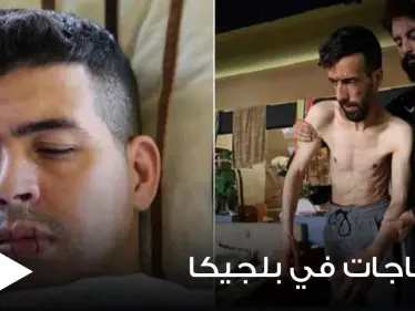 بالصور|| لاجئون في بلجيكا يخيطون أفواههم للإضراب عن الطعام احتجاجاً على أوضاعهم - وكالة ستيب نيوز