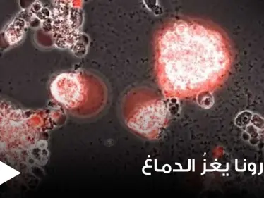 بالفيديو|| في تصوير نادر.. فيديو يوثق كيف يغزو فيروس كورونا خلايا الدماغ - وكالة ستيب نيوز