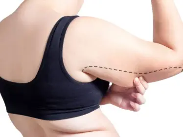 شد ترهلات الجلد.. عملية شائعة .. فوائدها وأضرارها ونصائح هامة - وكالة ستيب نيوز