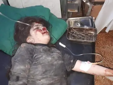 صور للقصف و الجرحى في بلدة كفرعويد بجبل الزاوية في ريف إدلب . - وكالة ستيب نيوز