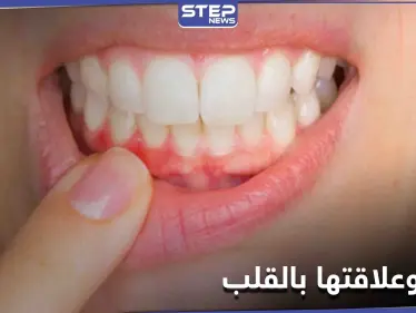 علامات تحذيرية غير معروفة موجودة في الفم قد تكشف أمراض القلب مبكراً - وكالة ستيب نيوز