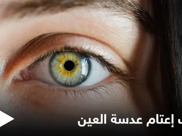 التدخين أحد أسبابه.. إعتام عدسة العين وخطورته وأبرز المسببات لحدوثه إليك اهم المعلومات - وكالة ستيب نيوز
