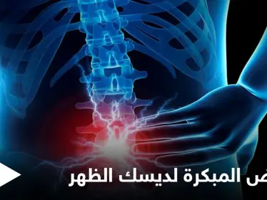 من أمراض العصر.. ديسك الظهر إليك أعراضه المبكرة وطرق علاجه - وكالة ستيب نيوز