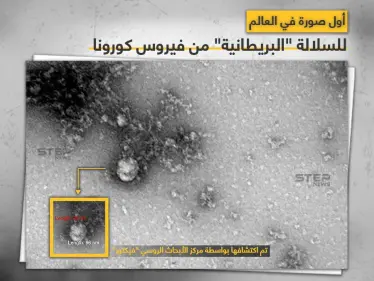 أول صورة في العالم للسلالة "البريطانية" من فيروس كورونا - وكالة ستيب نيوز