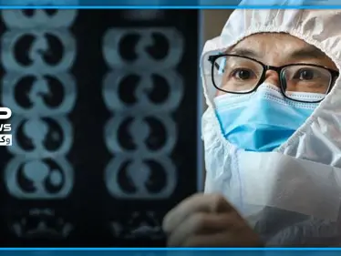 شاهد|| كيف أصبحت بشرتهما سوداء.. حالة غريبة تصيب طبيبين مصابين بكورونا في مستشفى ووهان - وكالة ستيب نيوز