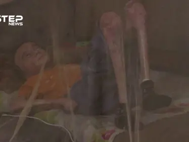 هذه قصة صهيب الصالح الطفل الذي يعاني من مرض جلدي نادر - وكالة ستيب نيوز