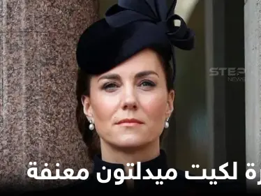 شاهد|| صورة للدوقة كيت ميدلتون معنفة بوجه مشوه تثير الجدل والغضب في بريطانيا - وكالة ستيب نيوز