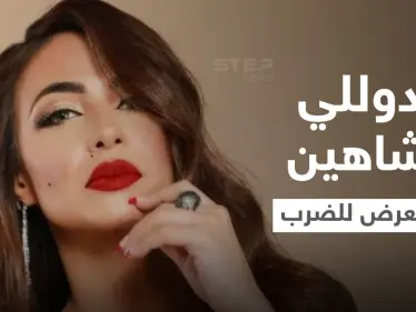 دوللي شاهين تتعرض للضرب المبرح وتنشر صور الكدمات التي ظهرت على وجهها وجسدها ومدير أعمالها يوضح (صور) - وكالة ستيب نيوز