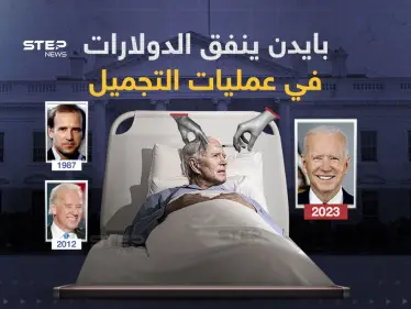 أحد كبار جراحي التجميل في كاليفورنيا يكشف عن عمليات تجميل خضع لها الرئيس الأمريكي - وكالة ستيب نيوز