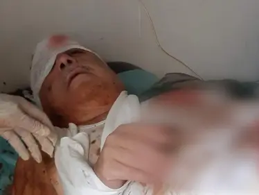 إصابة المسؤول الأول عن مجزرة البيضا بجراح بالغة نتيجة عبوة ناسفة!! - وكالة ستيب نيوز