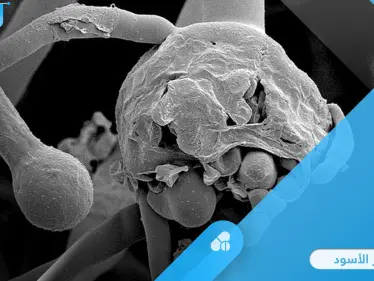 مرض نادر وخطير.. الفطر الأسود أكثر أنواع الفطريات فتكاً تعرف على طرق انتقاله وكيفية علاجه - وكالة ستيب نيوز