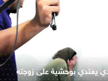 شاهد|| فقأ عينيها.. سعودي يعتدي بوحشية على زوجته وهاشتاغ "الضحية منى أنقذوها" يشعل المنصات - وكالة ستيب نيوز