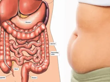 طرق تنظيف القولون طبيعياً دون أطباء ومشافي.. إليك 5 منها - وكالة ستيب نيوز