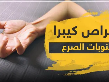 أقراص كيبرا لعلاج نوبات الصرع - وكالة ستيب نيوز