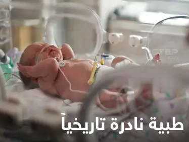 بحالة طبية نادرة للغاية.. ولادة طفل برازيلي بذيل بشري حقيقي مع كرة بنهايته (صور) - وكالة ستيب نيوز