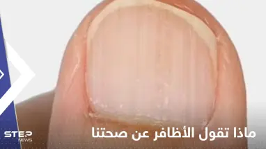 ماذا تقول الأظافر عن صحتنا؟.. تعرف على الحالات الخطيرة