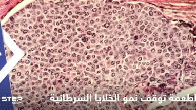 علماء يكتشفون أطعمة توقف نمو الخلايا السرطانية في الجسم وتمنع انتشارها
