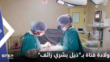 شاهد|| بظاهرة نادرة للغاية.. ولادة فتاة في البرازيل بـ"ذيل بشري زائف"