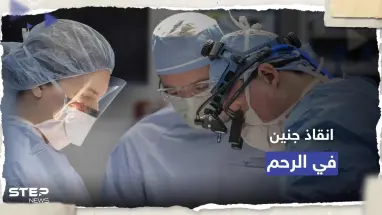 الأولى من نوعها.. جراحة ناجحة لدماغ جنين برحم أمه