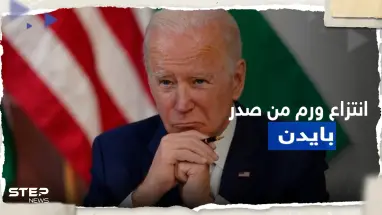 إزالة "ورم جلدي" من صدر بايدن وطبيبه يكشف 3 أمراض يعاني منها