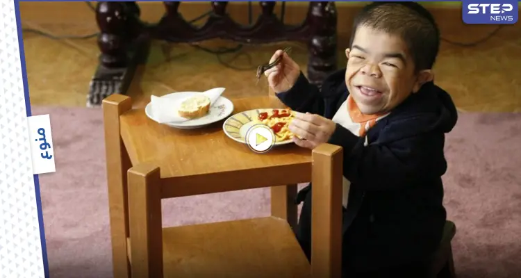 بالفيديو|| غينيس تكشف عن أقصر شخص في العالم وأسباب الوفاة المبكرة لقصار القامة تاريخياً: أخبار