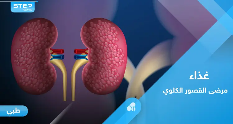 القصور الكلوي.. إليك النظام الغذائي الأمثل لتجنب تفاقم المرض: أخبار