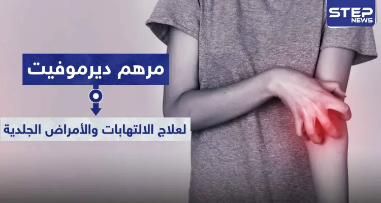 مرهم ديرموفيت Dermovate لعلاج الالتهابات والأمراض الجلدية: أخبار