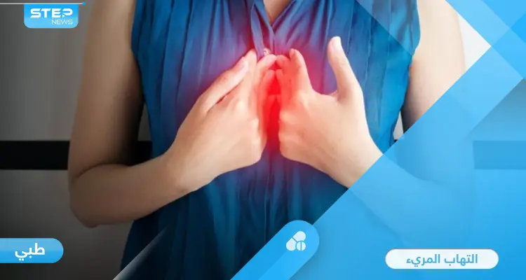 ما هو التهاب المريء ومضاعفاته الخطيرة وطرق العلاج إليك أهم المعلومات: أخبار