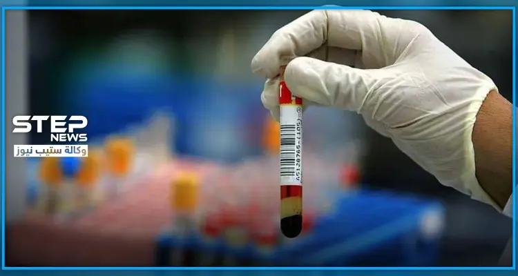 سيهمك التعرف إليها.. علماء ووهان يكشفون زمر الدم الأكثر والأقل عرضة للإصابة بكورونا: أخبار