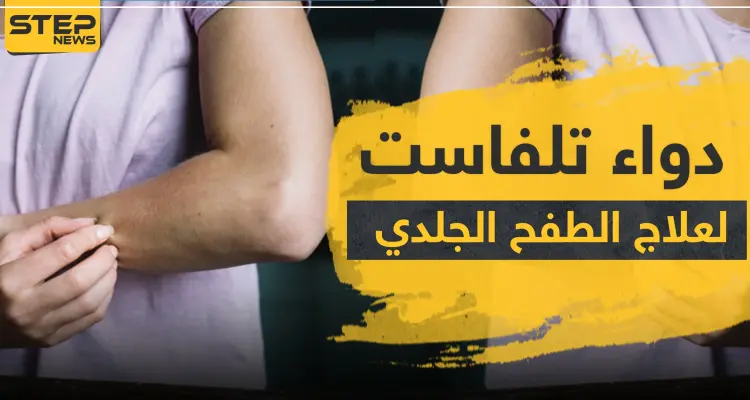 دواء تلفاست لعلاج الطفح الجلدي: أخبار