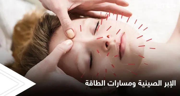 العلاج عن طريق الوخز بالإبر ومسارات الطاقة.. أسرار الطريقة الصينية المتبعة منذ القدم: أخبار