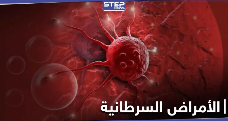 نصائح هامة عليك معرفتها.. لتجنب الإصابة بالأمراض السرطانية القاتلة: أخبار